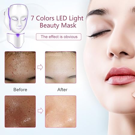 Luxus LED Gesichtsmaske, 7-farbige klare Anti-Aging Gesichtsmaske, zielt auf Akne Flecken und Falten (EU Version mit EU Stecker)