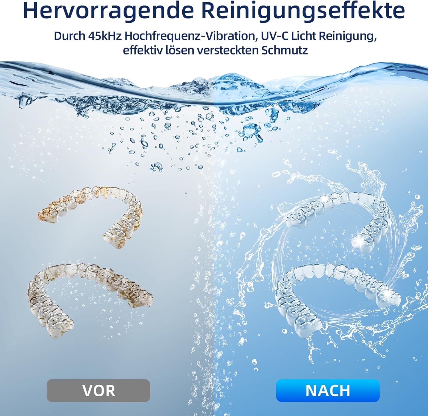Ultraschallreinigungsgerät 45 kHz mit UV-Reinigung – Für Zahnschienen, Retainer, Prothesen, Schmuck & Zahnbürstenköpfe | 4 Reinigungsmodi | Schwarz